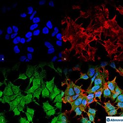 Kcnj8, Mouse anti-Rat, Clone: S366-60, Abnova 100&mu;g; Unconjugated:Antibodies,
