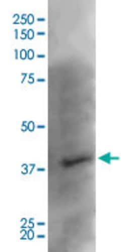Kcnj8, Mouse anti-Rat, Clone: S366-60, Abnova 100&mu;g; Unconjugated:Antibodies,