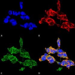 O-GalNAc, Mouse anti-Human, Biotin, Clone: 9B9, Abnova 100&mu;g; Biotin:Antibodies,