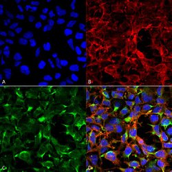 Dityrosine, Mouse anti-Human, Clone: 7D4, Abnova 100&mu;g; Unconjugated:Antibodies,
