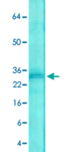 Kcnip2, Mouse anti-Rat, Biotin, Clone: FH9, Abnova 100&mu;g; Biotin:Antibodies,