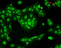 Camk2a, Mouse anti-Rat, ATTO390, Clone: 6G9, Abnova 100&mu;g; ATTO390:Antibodies,
