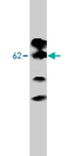 Adra2b, Mouse anti-Rat, Clone: 5G10, Abnova 100&mu;g; Unconjugated:Antibodies,