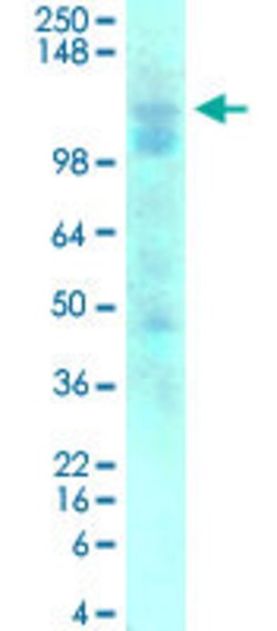 Gabbr1, Mouse anti-Rat, ATTO390, Clone: S93A-49, Abnova 100&mu;g; ATTO390:Antibodies,