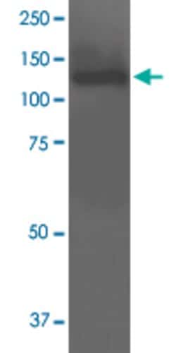 Abcc9, Mouse anti-Mouse, R-PE, Clone: S319A-14, Abnova 100&mu;g; R-PE:Antibodies,