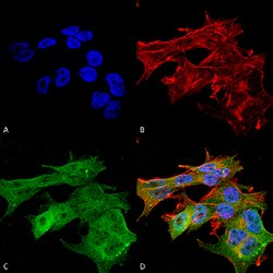 Vcan, Mouse anti-Mouse, R-PE, Clone: S351-23, Abnova 100&mu;g; R-PE:Antibodies,