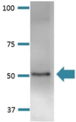 Kcnk3, Mouse anti-Rat, ATTO594, Clone: S374-48, Abnova 100&mu;g; ATTO594:Antibodies,