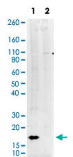 Histone H3 (phospho S10), Rabbit anti-Human, Clone: 4B6, Abnova 200&mu;L;