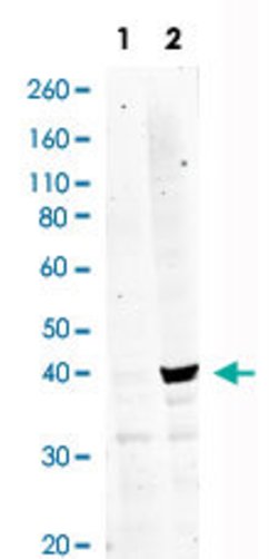 MAPKAPK2, Rabbit anti-Human, Clone: H2, Abnova 20 &mu;L | Buy Online | Abnova | Fisher Scientific