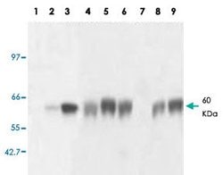 GNRHR, Mouse anti-Human, Clone: AT2.G7, Abnova 100&mu;g; Unconjugated:Antibodies,