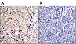 FOXO1, Rabbit anti-Human, Polyclonal Antibody, Abnova 100&mu;L; Unconjugated:Antibodies,