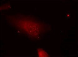 FOXO1, Rabbit anti-Human, Polyclonal Antibody, Abnova 100&mu;L; Unconjugated:Antibodies,