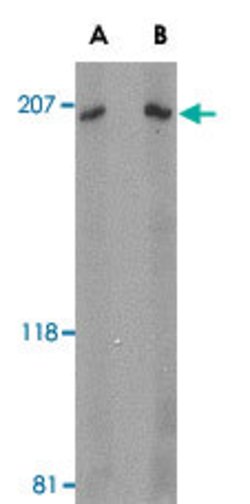 ARHGEF17, Rabbit anti-Human, Polyclonal Antibody, Abnova 100 &mu;g | Buy Online | Abnova | Fisher Scientific