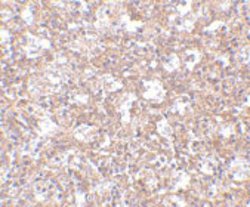 ARHGEF17, Rabbit anti-Human, Polyclonal Antibody, Abnova 100 &mu;g | Buy Online | Abnova | Fisher Scientific