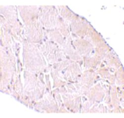 WNT10A, Rabbit anti-Human, Polyclonal Antibody, Abnova 100&mu;g; Unconjugated:Antibodies,