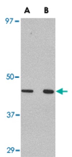 WNT10A, Rabbit anti-Human, Polyclonal Antibody, Abnova 100&mu;g; Unconjugated:Antibodies,