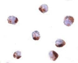 ANP32A, Rabbit anti-Human, Polyclonal Antibody, Abnova 100 &mu;g | Buy Online | Abnova | Fisher Scientific