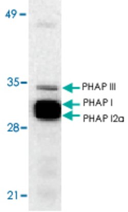 ANP32A, Rabbit anti-Human, Polyclonal Antibody, Abnova 100 &mu;g | Buy Online | Abnova | Fisher Scientific