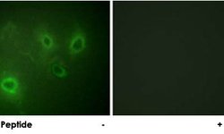 ITPR1, Rabbit anti-Human, Polyclonal Antibody, Abnova 100&mu;g; Unconjugated:Antibodies,