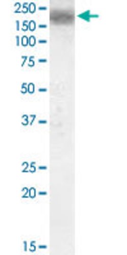LRP4, Goat anti-Human, Polyclonal Antibody, Abnova 100&mu;g; Unconjugated:Antibodies,