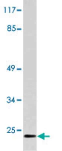NMU, Rabbit anti-Human, Polyclonal Antibody, Abnova 100&mu;L; Unconjugated:Antibodies,