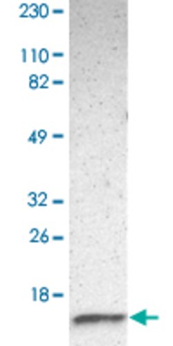 RBX1, Rabbit anti-Human, Polyclonal Antibody, Abnova 100&mu;L; Unconjugated:Antibodies,