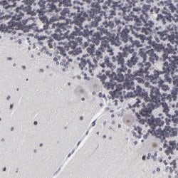 RBX1, Rabbit anti-Human, Polyclonal Antibody, Abnova 100&mu;L; Unconjugated:Antibodies,