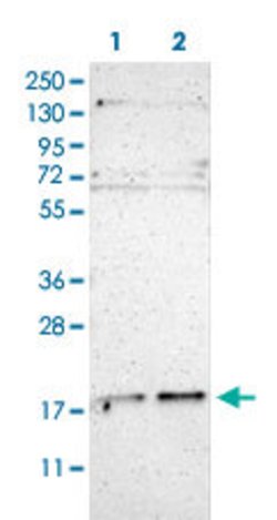 UBE2G2, Rabbit anti-Human, Polyclonal Antibody, Abnova 100&mu;L; Unconjugated:Antibodies,