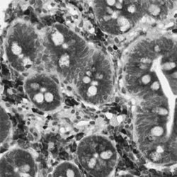 UBE2G2, Rabbit anti-Human, Polyclonal Antibody, Abnova 100&mu;L; Unconjugated:Antibodies,