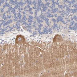 SEPT11, Rabbit anti-Human, Polyclonal Antibody, Abnova 100&mu;L; Unconjugated:Antibodies,