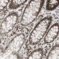 E2F1, Rabbit anti-Human, Polyclonal Antibody, Abnova 100&mu;L; Unconjugated:Antibodies,