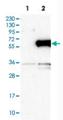E2F1, Rabbit anti-Human, Polyclonal Antibody, Abnova 100&mu;L; Unconjugated:Antibodies,