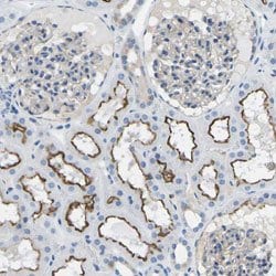 MC4R, Rabbit anti-Human, Polyclonal Antibody, Abnova 100&mu;L; Unconjugated:Antibodies,