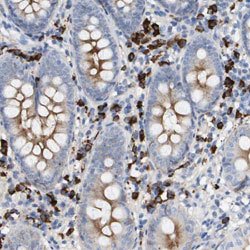 IFNAR1, Rabbit anti-Human, Polyclonal Antibody, Abnova 100&mu;L; Unconjugated:Antibodies,