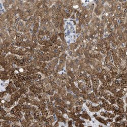 CALHM1, Rabbit anti-Human, Polyclonal Antibody, Abnova 100 &mu;L | Buy Online | Abnova | Fisher Scientific