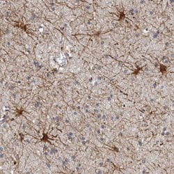 ADCK5, Rabbit anti-Human, Polyclonal Antibody, Abnova 100 &mu;L | Buy Online | Abnova | Fisher Scientific