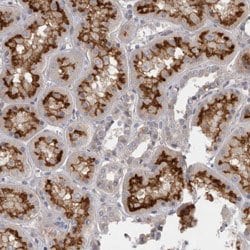 SLC22A11, Rabbit anti-Human, Polyclonal Antibody, Abnova 100 &mu;L | Buy Online | Abnova | Fisher Scientific