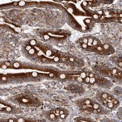 RAGE, Rabbit anti-Human, Polyclonal Antibody, Abnova 100 &mu;L | Buy Online | Abnova | Fisher Scientific