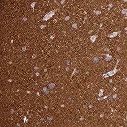 GNAZ, Rabbit anti-Human, Polyclonal Antibody, Abnova 100&mu;L; Unconjugated:Antibodies,