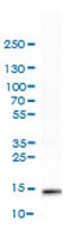 IFITM3, Rabbit anti-Human, Polyclonal Antibody, Abnova 100&mu;L; Unconjugated:Antibodies,