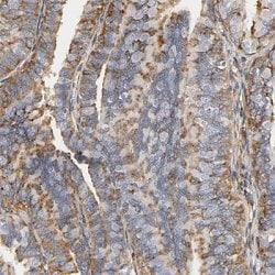 IFITM3, Rabbit anti-Human, Polyclonal Antibody, Abnova 100&mu;L; Unconjugated:Antibodies,