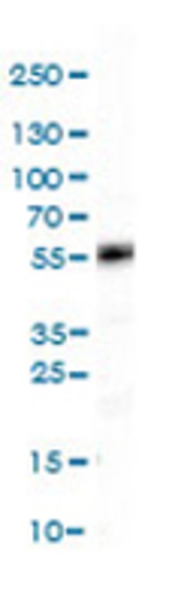 HNF4A, Rabbit anti-Human, Polyclonal Antibody, Abnova 100 &mu;L | Buy Online | Abnova | Fisher Scientific