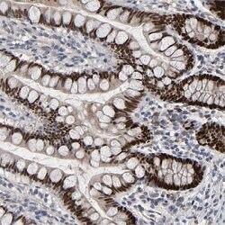 HNF4A, Rabbit anti-Human, Polyclonal Antibody, Abnova 100 &mu;L | Buy Online | Abnova | Fisher Scientific