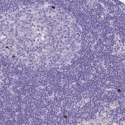 TNFSF11, Rabbit anti-Human, Polyclonal Antibody, Abnova 100&mu;L; Unconjugated:Antibodies,