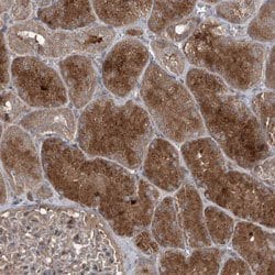 MAPK8IP2, Rabbit anti-Human, Polyclonal Antibody, Abnova 100&mu;L; Unconjugated:Antibodies,