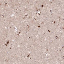 ARSB, Rabbit anti-Human, Polyclonal Antibody, Abnova 100&mu;L; Unconjugated:Anticorps,