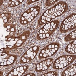 ANAPC4, Rabbit anti-Human, Polyclonal Antibody, Abnova 100 &mu;L | Buy Online | Abnova | Fisher Scientific