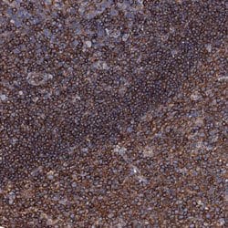 MS4A4E, Rabbit anti-Human, Polyclonal Antibody, Abnova 100 &mu;L | Buy Online | Abnova | Fisher Scientific