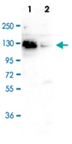 CTCF, Rabbit anti-Human, Polyclonal Antibody, Abnova 50&mu;g; Unconjugated:Antibodies,