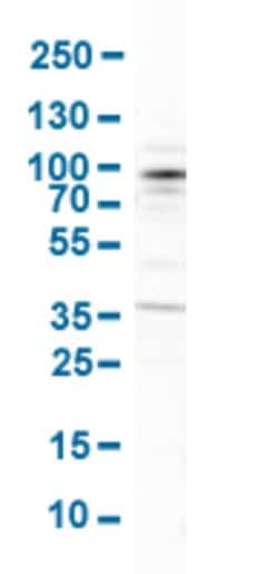 ARHGEF7, Rabbit anti-Human, Polyclonal Antibody, Abnova 100&mu;L; Unconjugated:Antibodies,